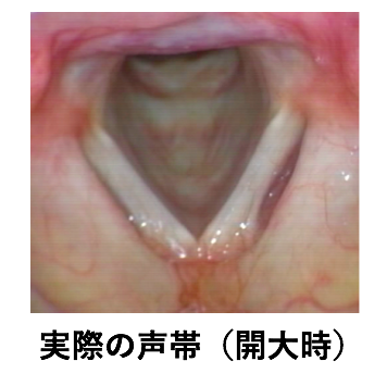 声帯を横から見た図